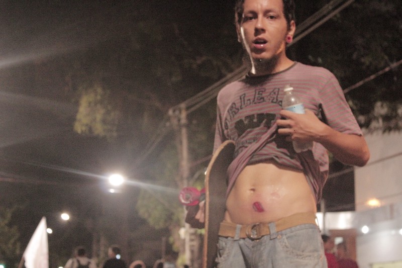 Um dos manifestantes que foram alvo dos crimes da ROTAM, na noite do dia 2. (Carvalho da Costa/Arquivo Pessoal)