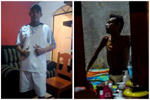 Patrick antes e depois de passar pelo inferno das cadeias do Pará: de 65 kg, ele passou para 36 kg - Foto: João Paulo Guimarães